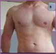 20 percent body fat - Male