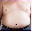 40 percent body fat - Male
